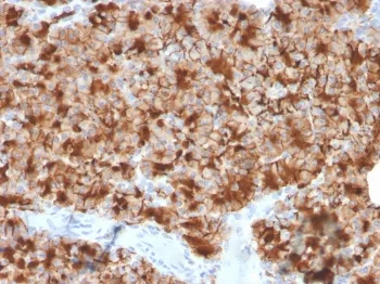 Glycoprotein 2 Antibody / GP2 / ZAP75 - image 1