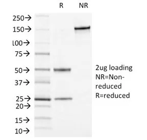 CD13 Antibody / ANPEP - image 1