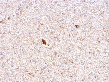 Serum Amyloid P Antibody - image 1