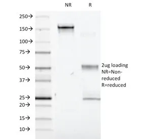 Interferon alpha 1 Antibody / IFNA1 - image 1
