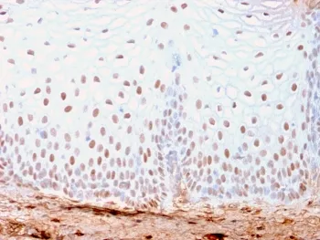 SOX2 Recombinant Antibody - image 1
