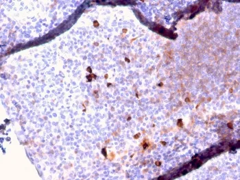 IgM Heavy Chain Recombinant Antibody - image 1