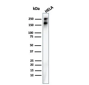 SPTBN2 Recombinant Antibody / Spectrin beta III - image 1