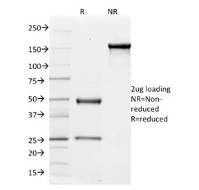 Integrin alpha V Antibody / ITGAV - image 1