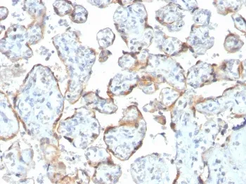 TIMP2 Recombinant Antibody - image 1
