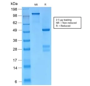 Gamma Catenin Recombinant Antibody / Plakoglobin - image 1