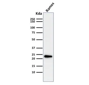 LMO2 Antibody / Rhombotin 2 - image 1