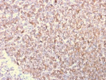 LSP1 Antibody / Lymphocyte Specific Protein 1 - image 1