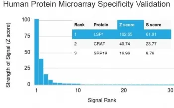 LSP1 Antibody / Lymphocyte Specific Protein 1 - image 1