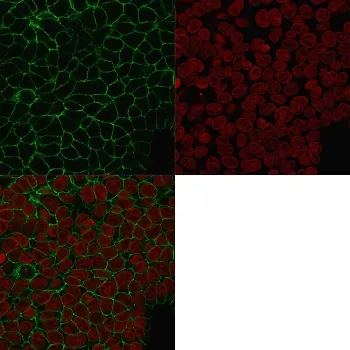 EpCAM Antibody - image 1