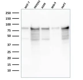 MCM7 Recombinant Antibody - image 1