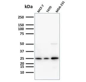 Mammaglobin A Antibody / SCGB2A2 - image 1