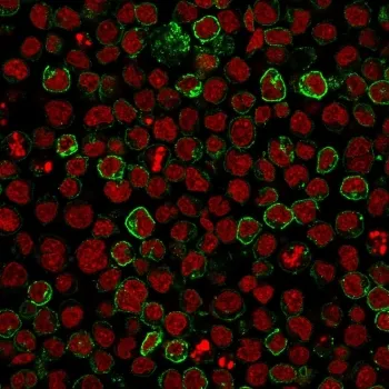 CD10 Antibody / Neprilysin - image 1
