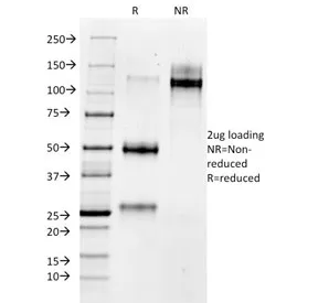 MMP3 Antibody / Matrix Metalloproteinase 3 - image 1