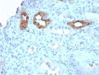 Calbindin Antibody / CALB1 - image 1