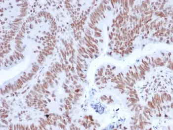 NRF1 Antibody / Nuclear Respiratory Factor 1 - image 1