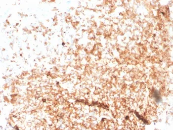 IgM Heavy Chain Recombinant Antibody - image 1