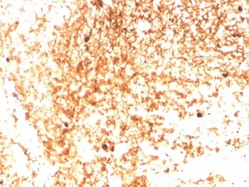 IgM Heavy Chain Recombinant Antibody - image 1