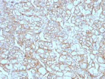 PD-L1 Recombinant Antibody / B7-H1 / CD274 - image 1