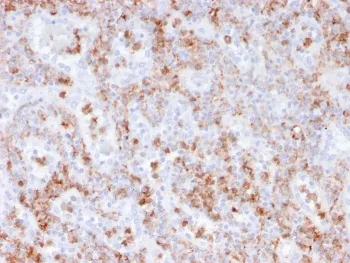 S100A9 Recombinant Antibody / MRP14 / Calgranulin B / Calprotectin L1H - image 1