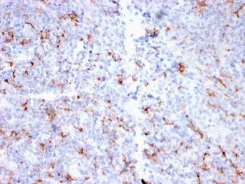 S100A9 + Calprotectin Recombinant Antibody - image 1
