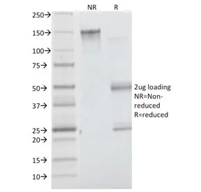 Insulin Receptor alpha Antibody - image 1