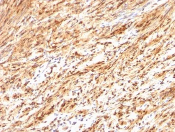 S100B Antibody - image 1