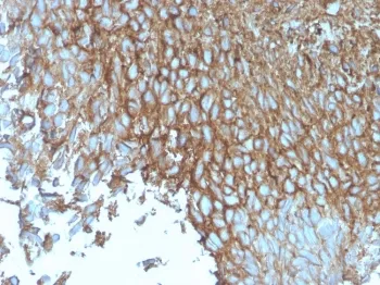 GLUT1 Recombinant Antibody / SLC2A1 - image 1