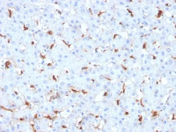 C1QB Antibody / Complement C1q B-Chain - image 1