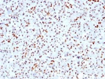 SOX9 Recombinant Antibody - image 1