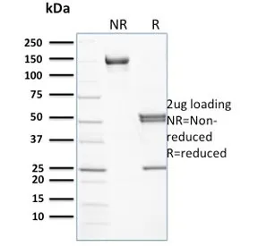 SPTB Antibody / Spectrin beta - image 1