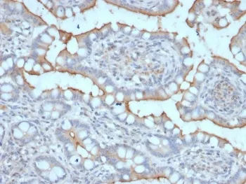 StAR Antibody / Steroidogenic acute regulatory protein - image 1