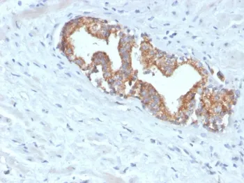 AMACR / p504S Recombinant Antibody (Prostate Cancer Marker) - image 1