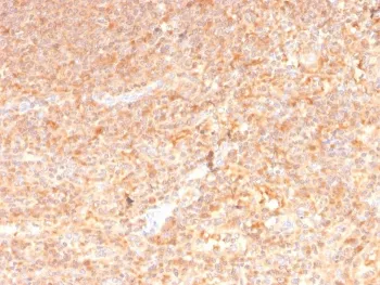 Granulocyte-Macrophage CSF Antibody / CSF2 - image 1