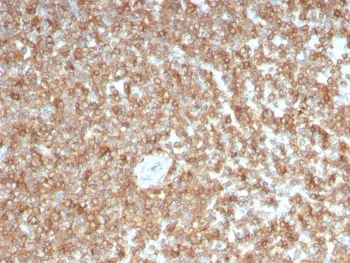 Granulocyte-Macrophage CSF Antibody / CSF2 - image 1