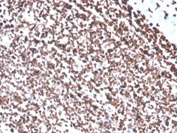 dsDNA Recombinant Antibody / Double Stranded DNA - image 1