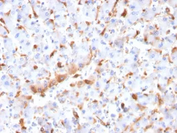 C1QB Antibody / Complement C1q B-Chain - image 1