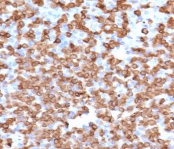 CD11b Antibody / MAC-1 - image 1