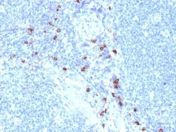 TPSAB1 Antibody / Mast Cell Tryptase - image 1