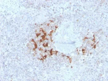 TRAF1 Antibody - image 1