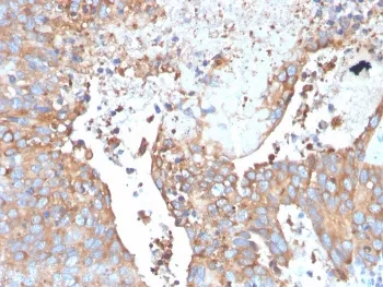 Uroplakin 1B Antibody / UPK1B - image 1