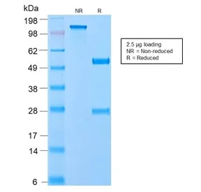 VLDLR Recombinant Antibody / VLDL Receptor - image 1