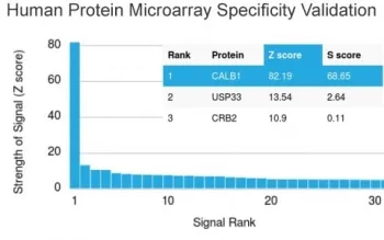 Calbindin Antibody / CALB1 - image 1