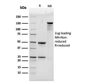 ACTN4 Antibody / Alpha Actinin 4 - image 1