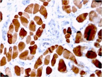 ACTN2 Antibody / Alpha Actinin 2 / Sarcomeric Alpha Actinin - image 1