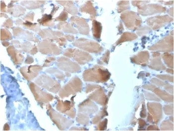 ACTN2 Antibody / Alpha Actinin 2 / Sarcomeric Alpha Actinin - image 1