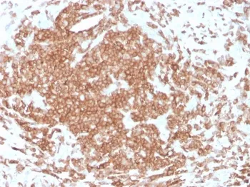 CD3 epsilon Recombinant Antibody - image 1