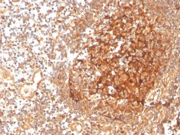 GCLM Antibody / Glutamate-Cysteine Ligase Regulatory Subunit - image 1
