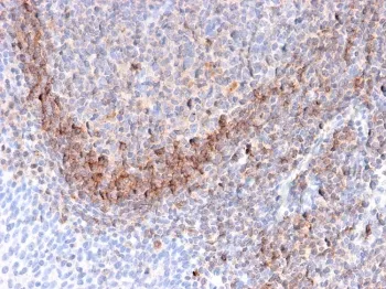 CD79b Antibody - image 1