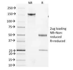 CD3 epsilon Antibody - image 1